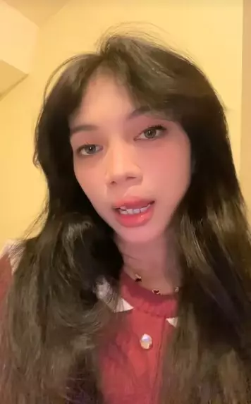 gadis bibir sumbing dioperasi gratis Dokter Tompi © TikTok gadis bibir sumbing dioperasi gratis Dokter Tompi © TikTok