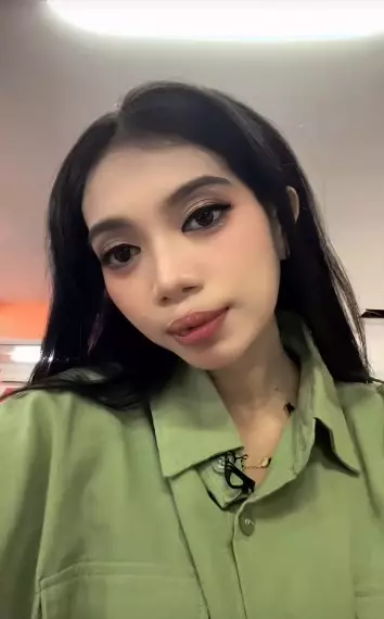 gadis bibir sumbing dioperasi gratis Dokter Tompi © TikTok gadis bibir sumbing dioperasi gratis Dokter Tompi © TikTok