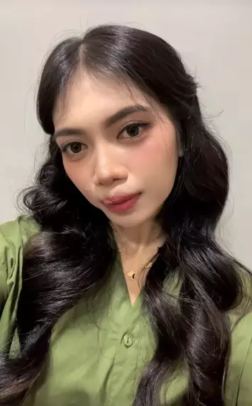 gadis bibir sumbing dioperasi gratis Dokter Tompi © TikTok gadis bibir sumbing dioperasi gratis Dokter Tompi © TikTok