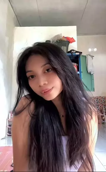 gadis bibir sumbing dioperasi gratis Dokter Tompi © TikTok gadis bibir sumbing dioperasi gratis Dokter Tompi © TikTok