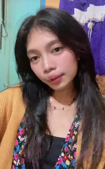 gadis bibir sumbing dioperasi gratis Dokter Tompi © TikTok gadis bibir sumbing dioperasi gratis Dokter Tompi © TikTok