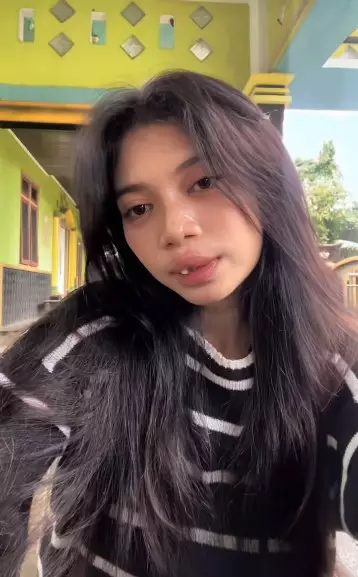 gadis bibir sumbing dioperasi gratis Dokter Tompi © TikTok gadis bibir sumbing dioperasi gratis Dokter Tompi © TikTok