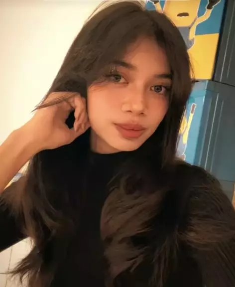 gadis bibir sumbing dioperasi gratis Dokter Tompi © TikTok gadis bibir sumbing dioperasi gratis Dokter Tompi © TikTok