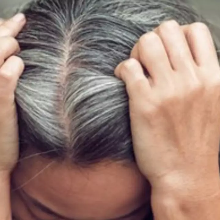 Kembalikan rambut putih uban jadi hitam lagi tanpa jintan, cuma dengan tambahan 2 bahan dapur