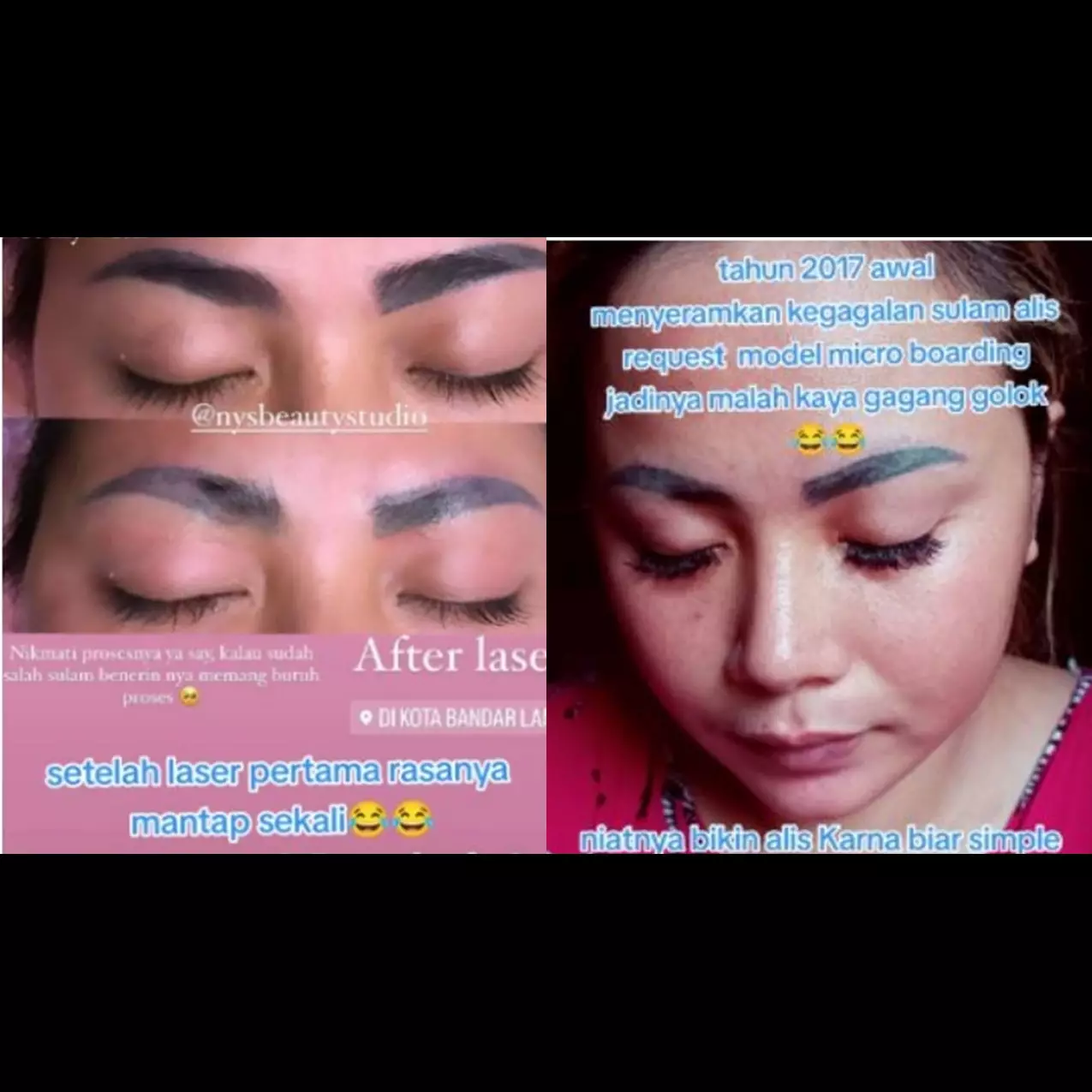 Cewek ini bagikan kisahnya saat laser alis penuh perjuangan, hasilnya di luar ekspektasi