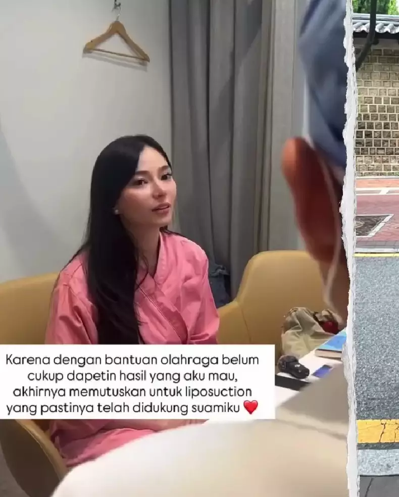 Asmirandah putuskan sedot lemak © Instagram