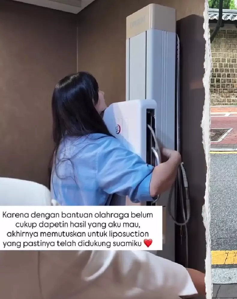 Asmirandah putuskan sedot lemak © Instagram