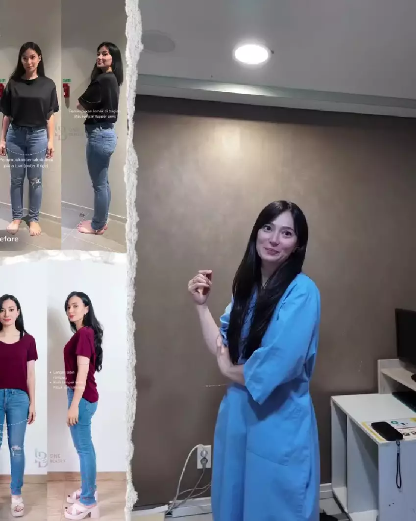 Asmirandah putuskan sedot lemak © Instagram