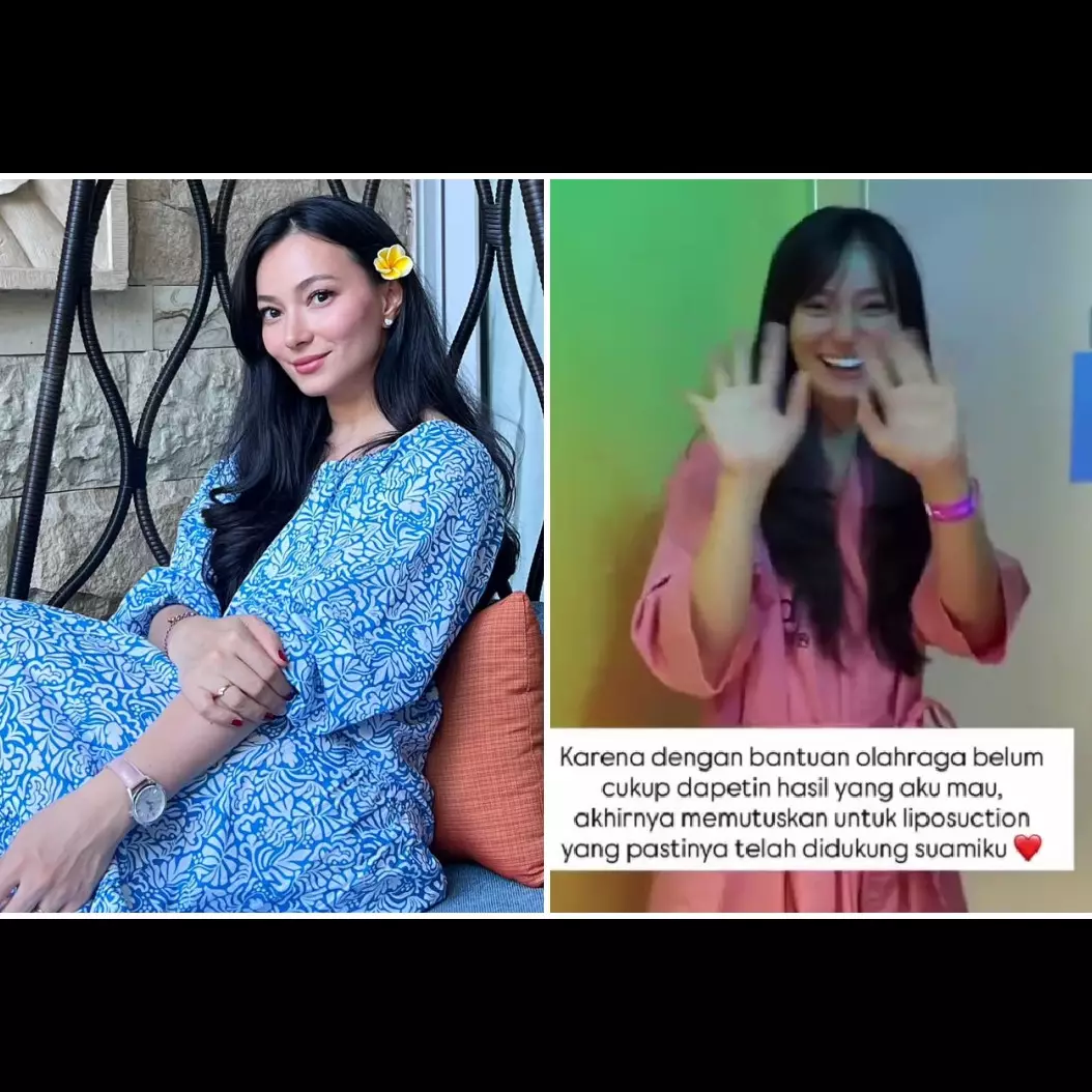 Asmirandah ingin badan ideal pasca melahirkan, putuskan sedot lemak, ini 9 potret hasilnya