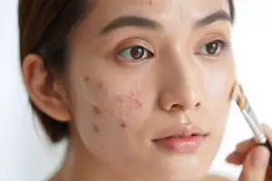 7 Langkah urutan makeup untuk kulit berjerawat agar tahan lama tanpa minyak