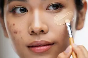 6 Rekomendasi concealer untuk menutupi bekas jerawat, noda hilang seketika