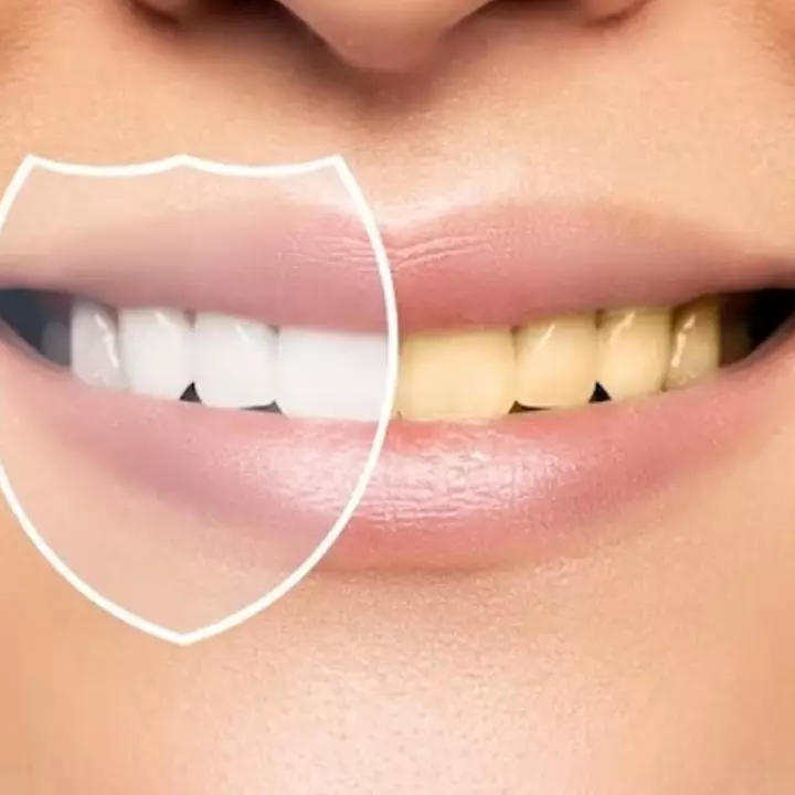 Gigi minim plak dan noda kuning tanpa repot pakai charcoal, wajib tahu trik ini