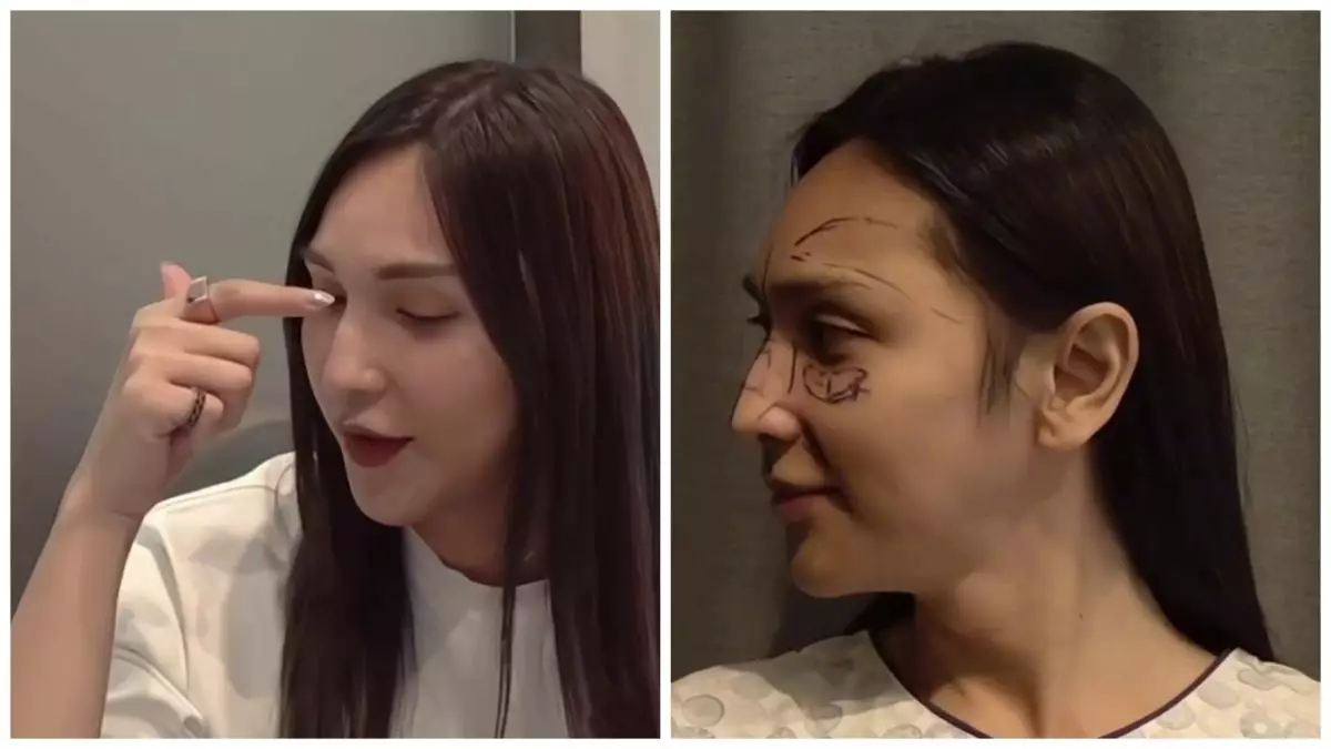 7 Potret Dena Rachman usai operasi plastik bagian hidung, dipuji makin cantik