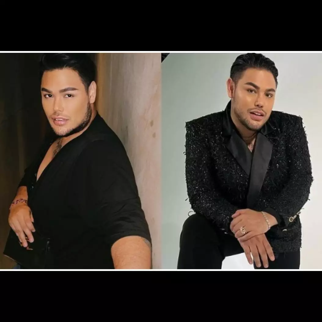 Sukses mendapat pujian saat berbadan kurus, begini foto lawas Ivan Gunawan saat masih jadi pacar Rossa