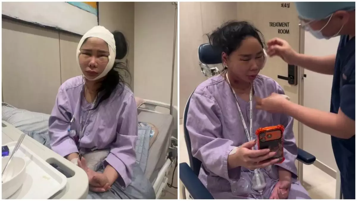 7 Potret Denise Chariesta jalani oplas wajah di Korea Selatan, ngaku habiskan dana Rp1 miliar