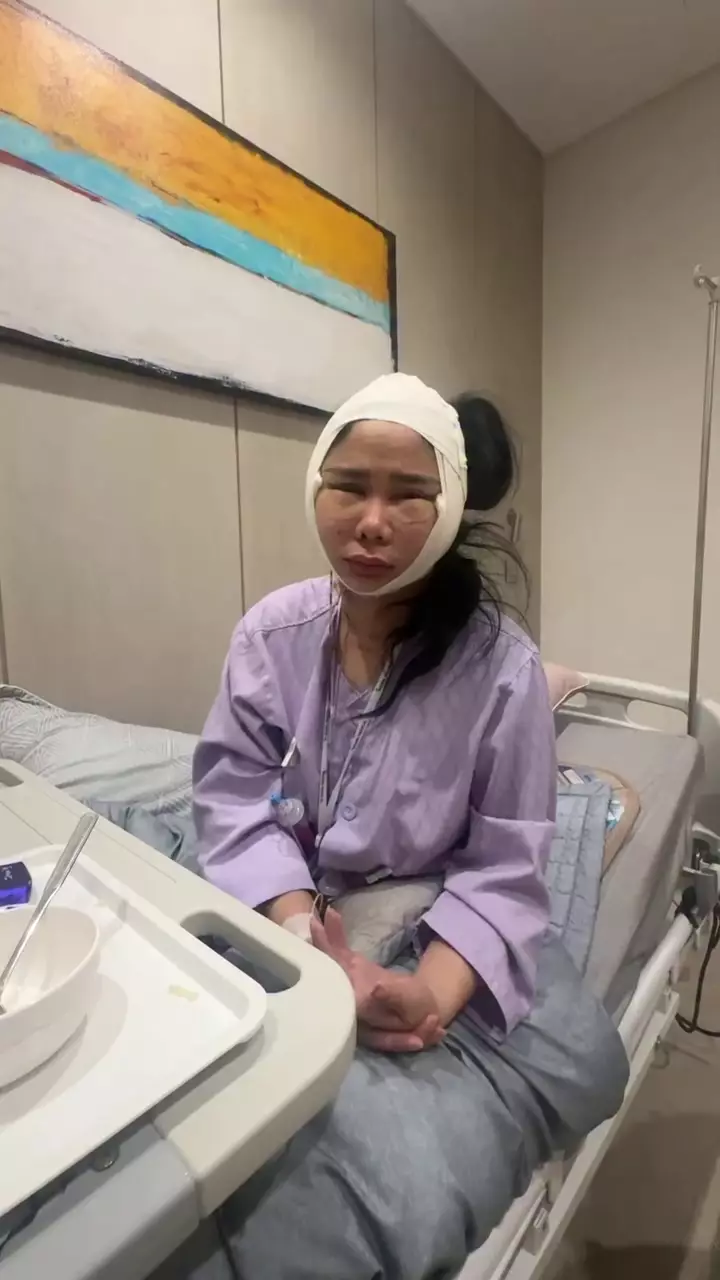 Denise Chariesta oplas wajah di Korea Selatan © 2025 Instagram Denise Chariesta oplas wajah di Korea Selatan © 2025 Instagram