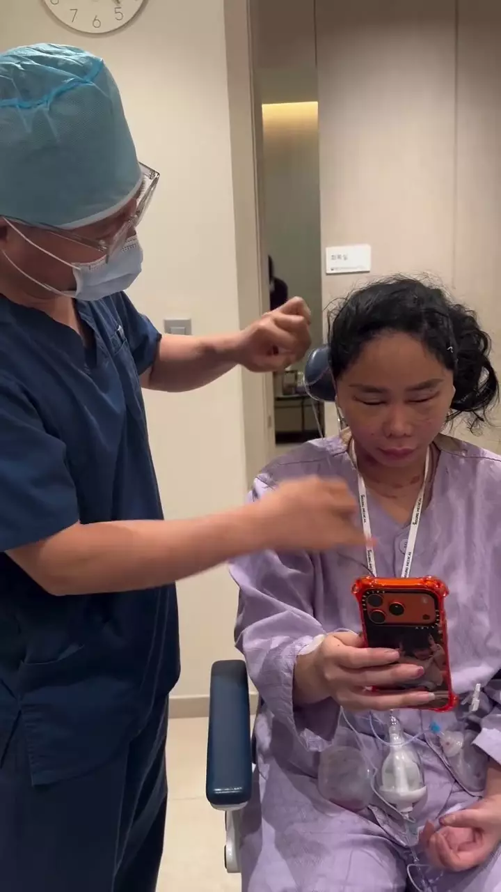 Denise Chariesta oplas wajah di Korea Selatan © 2025 Instagram Denise Chariesta oplas wajah di Korea Selatan © 2025 Instagram