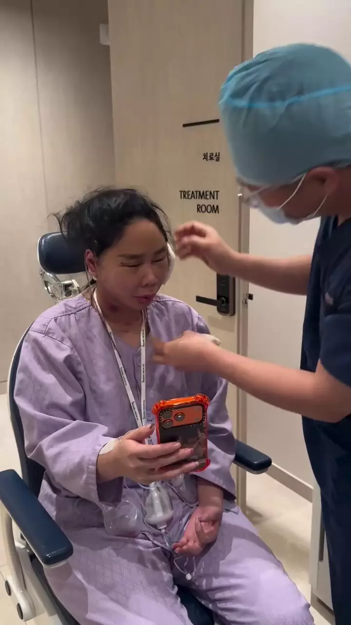 Denise Chariesta oplas wajah di Korea Selatan © 2025 Instagram Denise Chariesta oplas wajah di Korea Selatan © 2025 Instagram