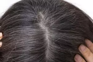 Trik menghitamkan kembali rambut beruban pakai 2 bahan dapur, tak pakai semir dan henna