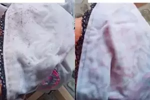 Noda jamur di pakaian bisa hilang dalam sekali usap, rahasianya ada di 1 bahan dapur ini