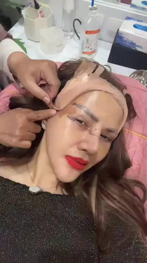 Barbie Kumalasari operasi plastik 8 kali © Instagram