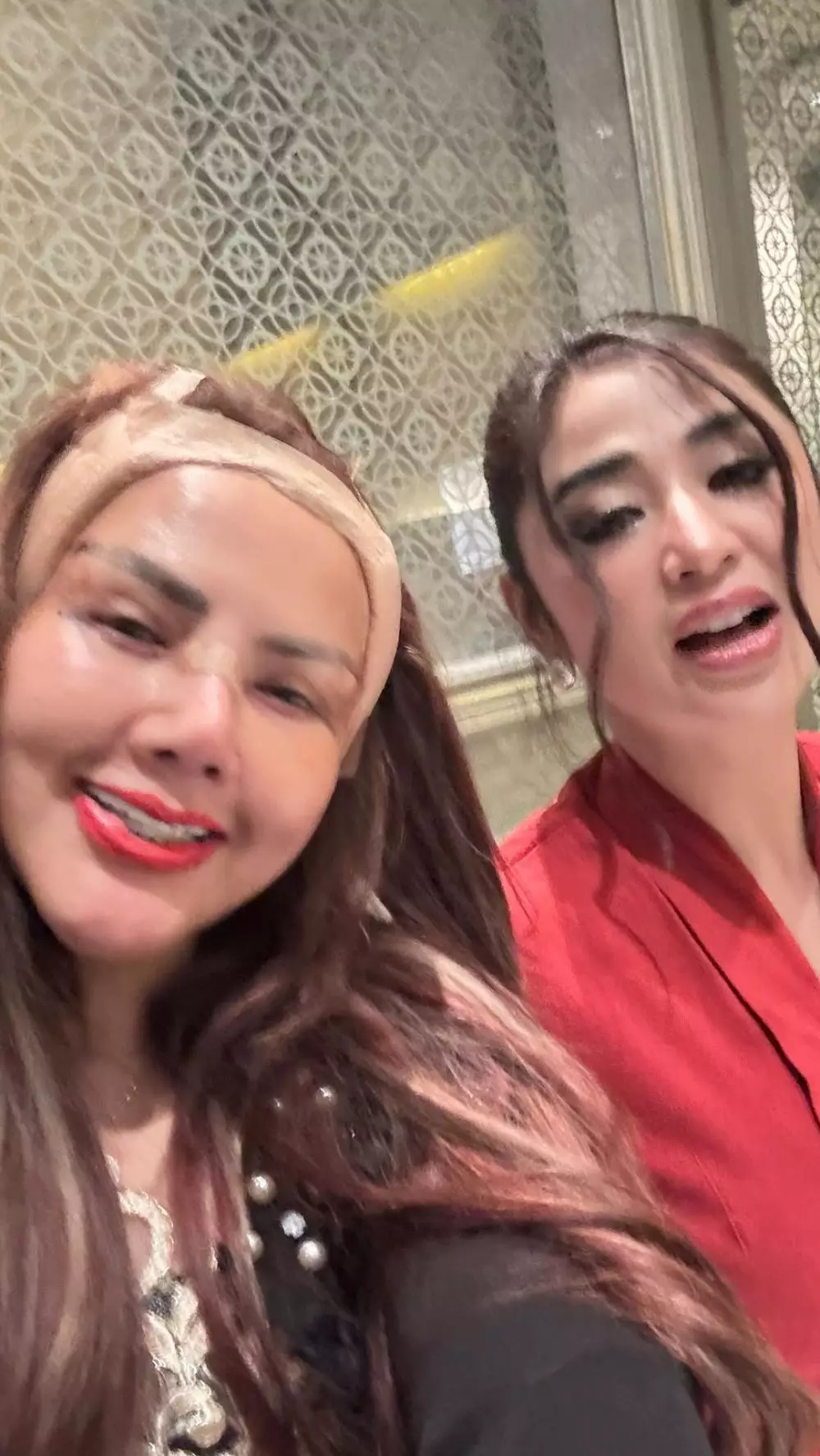 Barbie Kumalasari operasi plastik 8 kali © Instagram