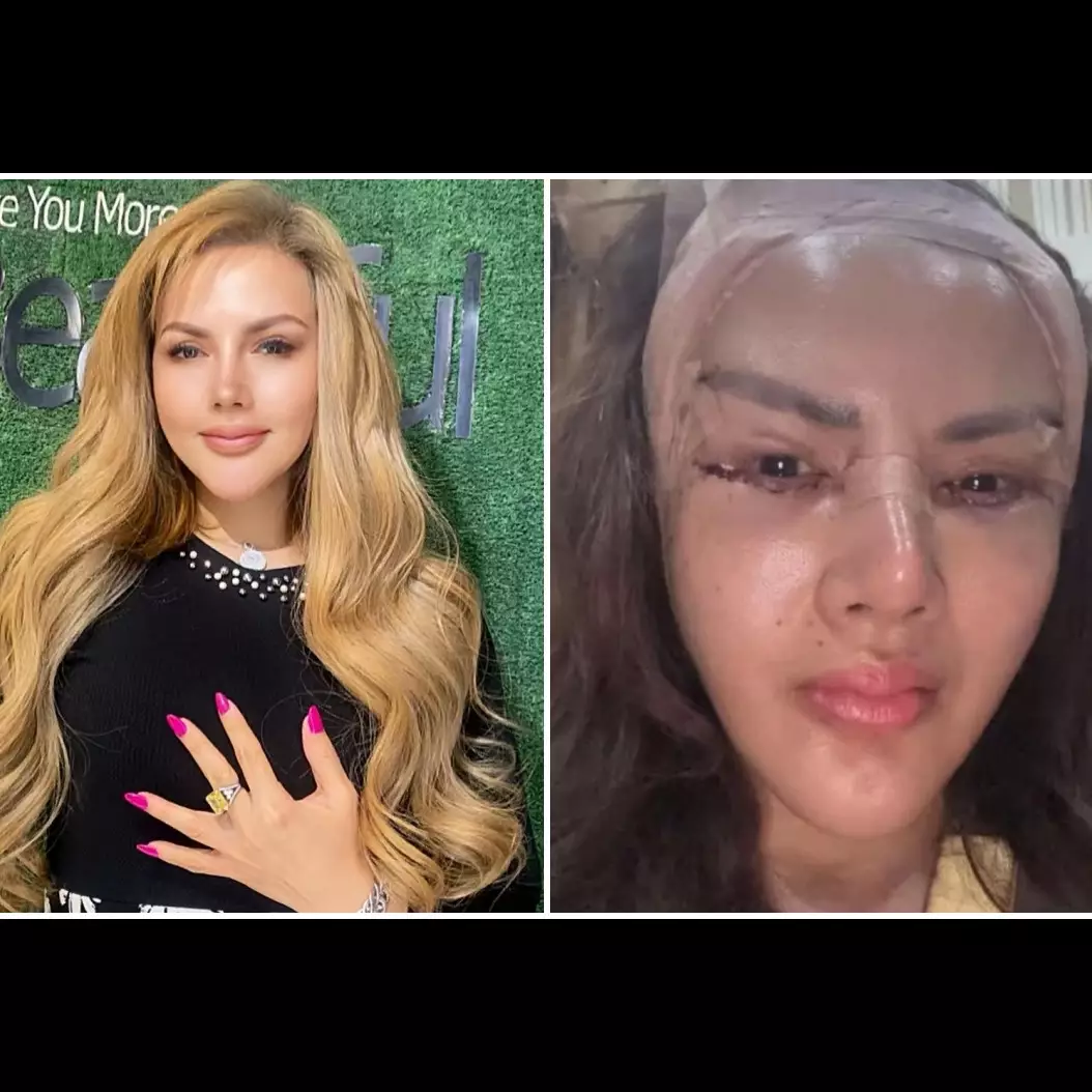 Menolak tua, Barbie Kumalasari sudah jalani operasi plastik 8 kali, ini 7 potret wajahnya kini