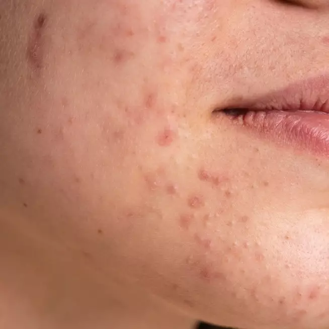 Kulit belang dan kusam? Coba trik cerahkan wajah cuma pakai 1 jenis tepung, hasilnya bikin kaget