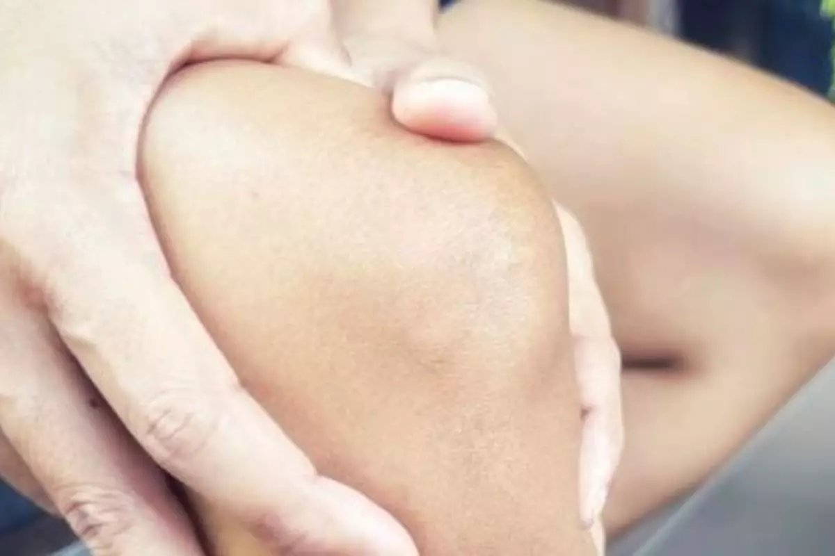 Cerah merata tanpa kunyit, ini rahasia scrub buah alami yang ampuh samarkan siku dan lutut hitam