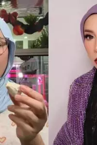 Banyak orang yang merasa ada yang berbeda dengan wajahnya hingga muncul spekulasi bahwa ia telah menjalani prosedur operasi plastik atau oplas.