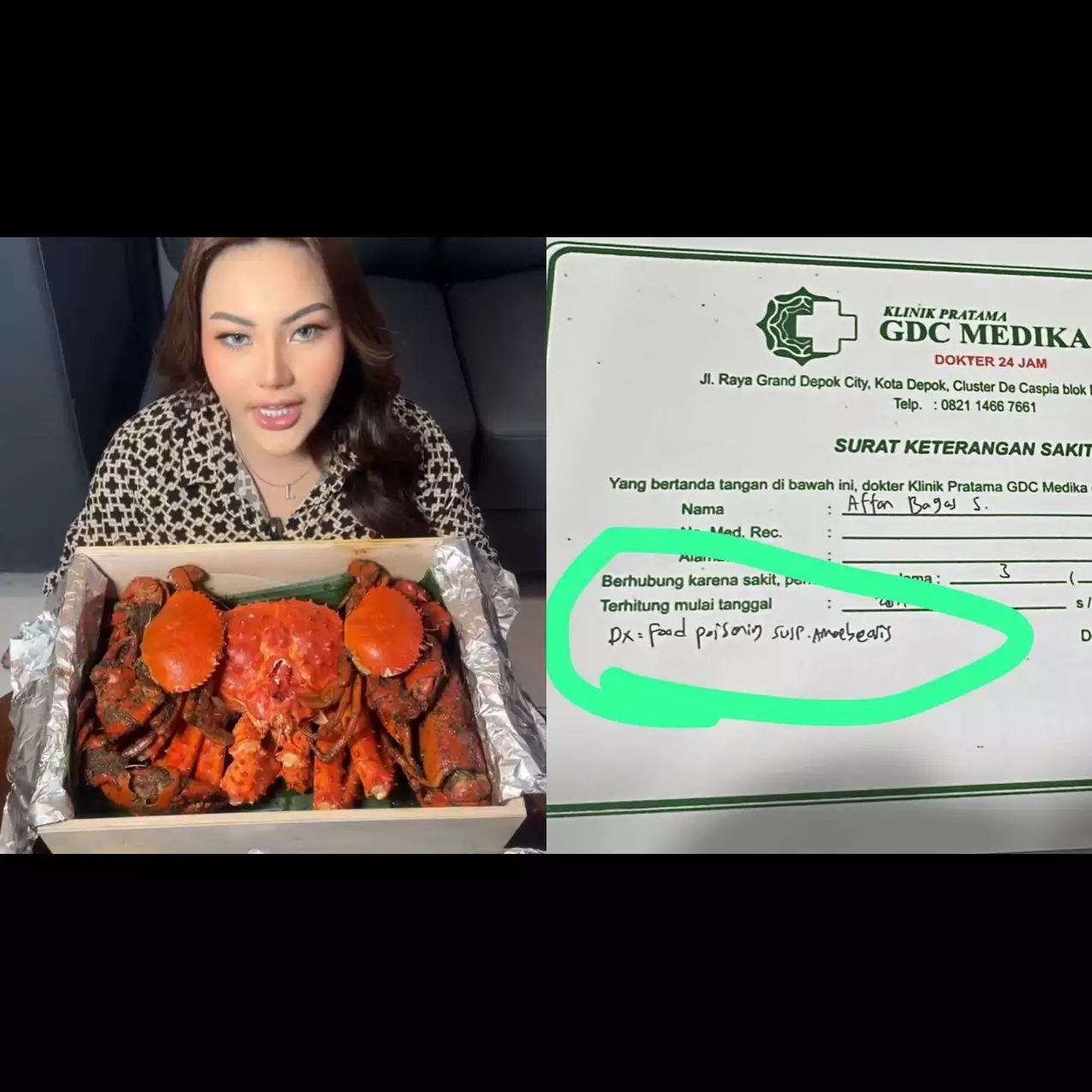 Kronologi Lisa Mariana sekeluarga keracunan kepiting Alaska, ibunda sampai dirawat di rumah sakit