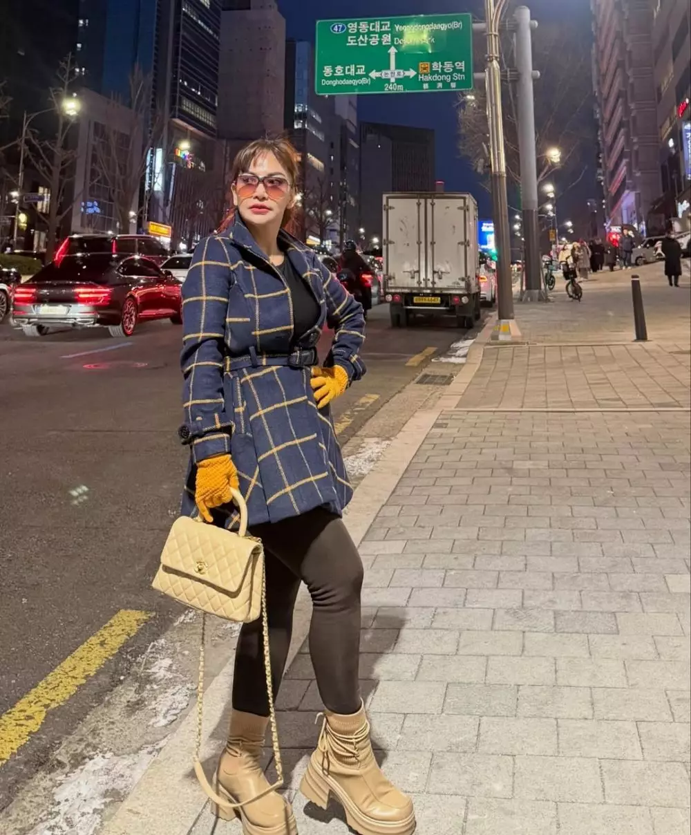 Irma Dharmawangsa pasca oplas Instagram/@irmadarmawangsa