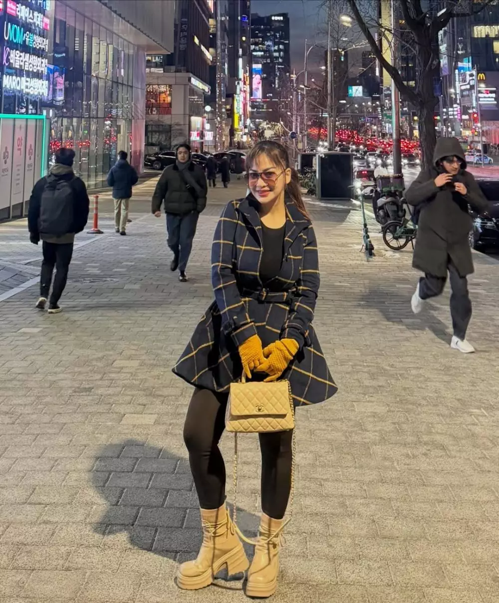 Irma Dharmawangsa pasca oplas Instagram/@irmadarmawangsa