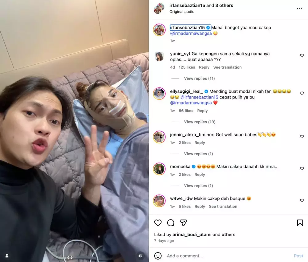 Irma Dharmawangsa pasca oplas Instagram/@irmadarmawangsa