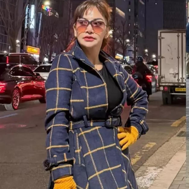 7 Potret Irma Darmawangsa pasca oplas, 3 hari setelahnya langsung main salju di Korea