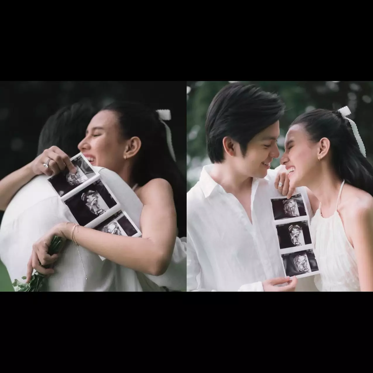 7 Potret maternity estetik Shenina Cinnamon dan Angga Yunanda, aura cantik bumil terpancar