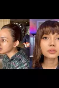 9 Potret Rina Nose pasca operasi hidung, hasil natural cantik tanpa bikin pangling