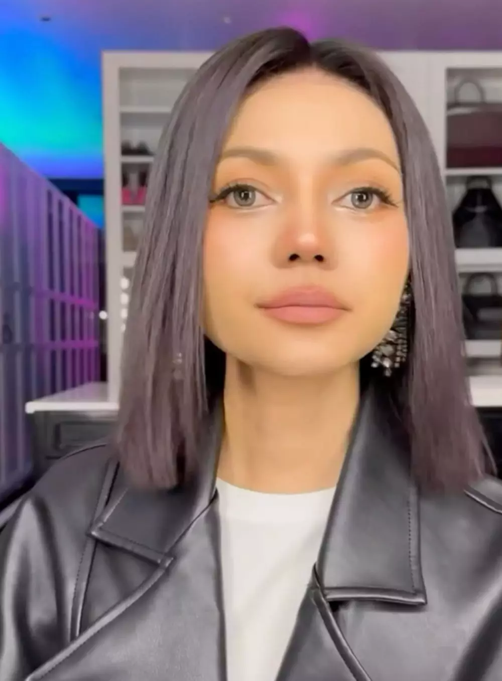 Rina Nose Operasi Hidung Instagram/@rinanose16