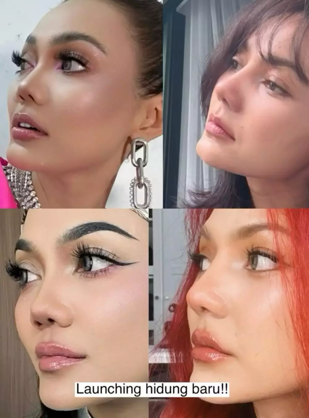 Rina Nose Operasi Hidung Instagram/@rinanose16