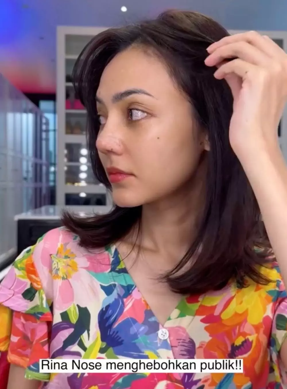 Rina Nose Operasi Hidung Instagram/@rinanose16