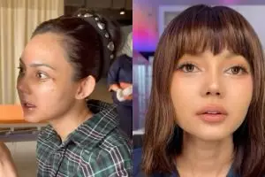 Sempat bilang hidungnya bawa hoki, Rina Nose kini akui menjilat ludah sendiri setelah operasi