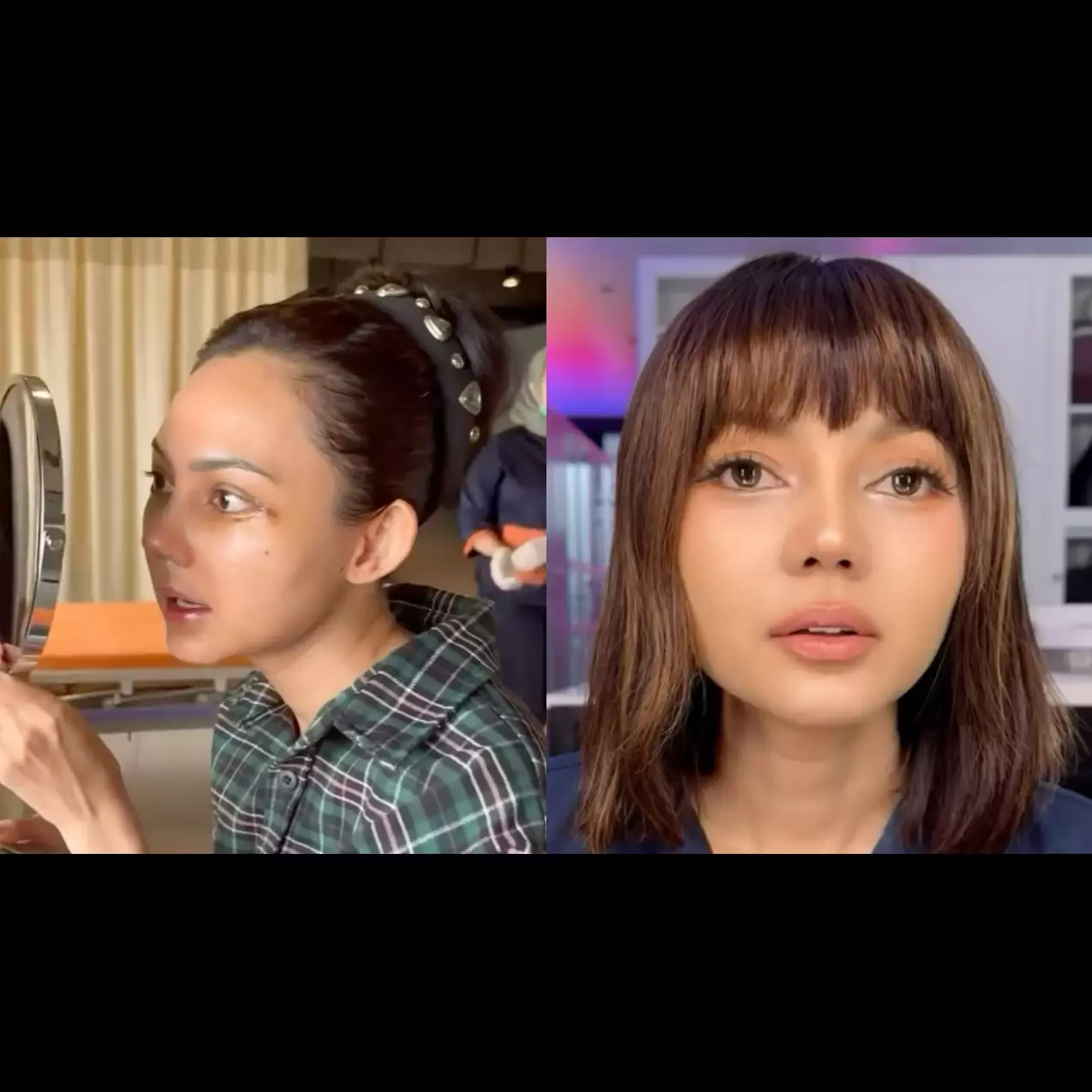 Sempat bilang hidungnya bawa hoki, Rina Nose kini akui menjilat ludah sendiri setelah operasi