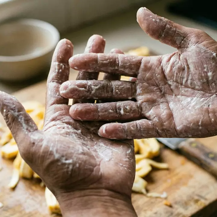 Getah nangka susah hilang meski sudah pakai sabun? coba trik daun jambu biji ini