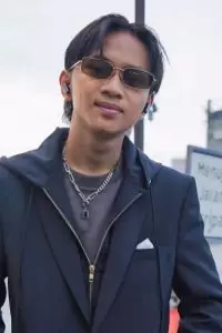 Kondisi terkini Fajar Sadboy usai kecelakaan akibat jalan licin, kuku copot hingga tulang cedera