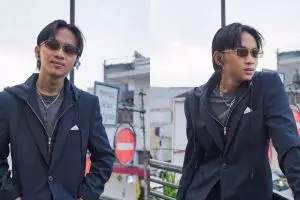 Kondisi terkini Fajar Sadboy usai kecelakaan akibat jalan licin, kuku copot hingga tulang cedera