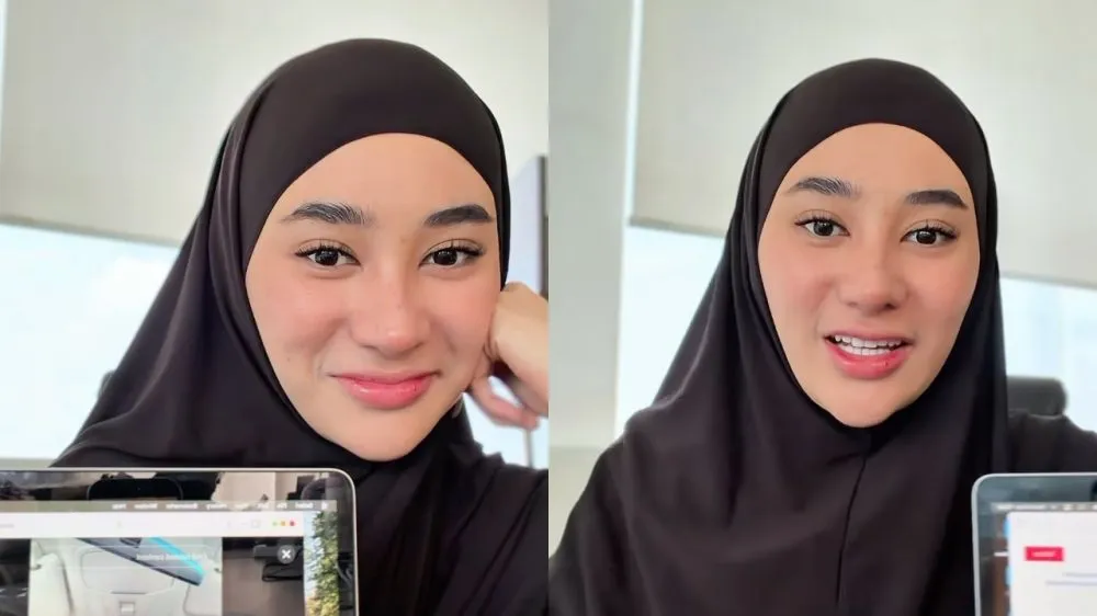 Clara Shinta Operasi Hidung © 2026 