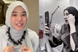 5 Potret terbaru Clara Shinta setelah operasi hidung, bikin orang pangling