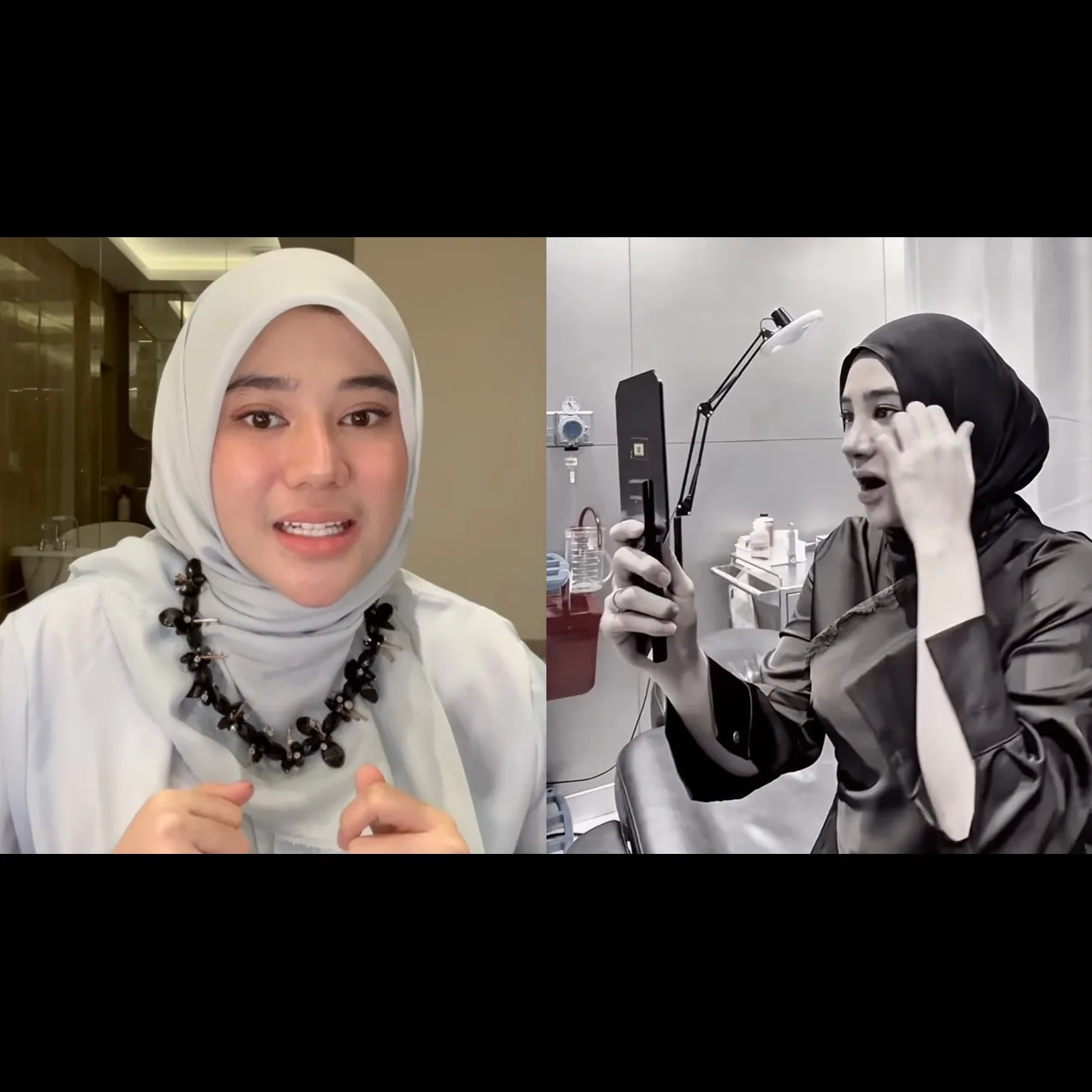 5 Potret terbaru Clara Shinta setelah operasi hidung, bikin orang pangling