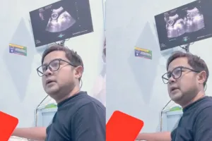Detik-detik dokter obgyn kabarkan janin meninggal dunia lewat layar USG, momen periksa berubah total