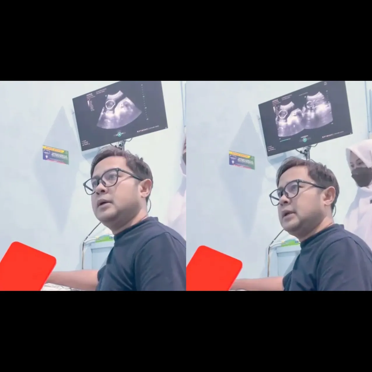 Detik-detik dokter obgyn kabarkan janin meninggal dunia lewat layar USG, momen periksa berubah total